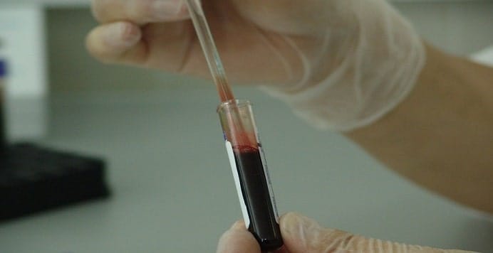 test de sangre tumores cancerígenos